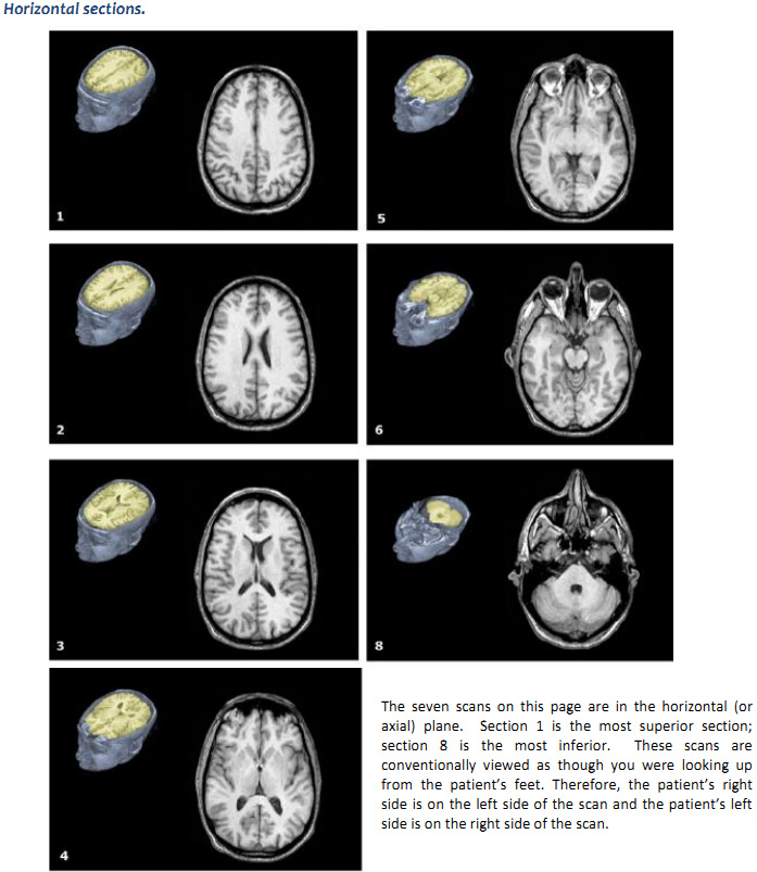 Duke Neurosciences Lab Brainstem Sectional Anatomy